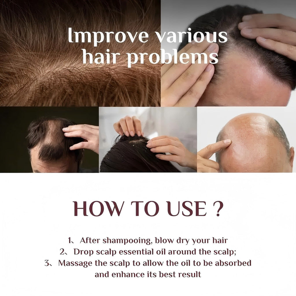 Aceite de Kemiri Anticaída y Crecimiento Capilar 55ml - GimidealAceite de Kemiri Anticaída y Crecimiento Capilar 55mlGimidealGimideal1 PcsAceite de Kemiri Anticaída y Crecimiento Capilar 55ml