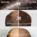 Aceite de Kemiri Anticaída y Crecimiento Capilar 55ml - GimidealAceite de Kemiri Anticaída y Crecimiento Capilar 55mlGimidealGimideal1 PcsAceite de Kemiri Anticaída y Crecimiento Capilar 55ml