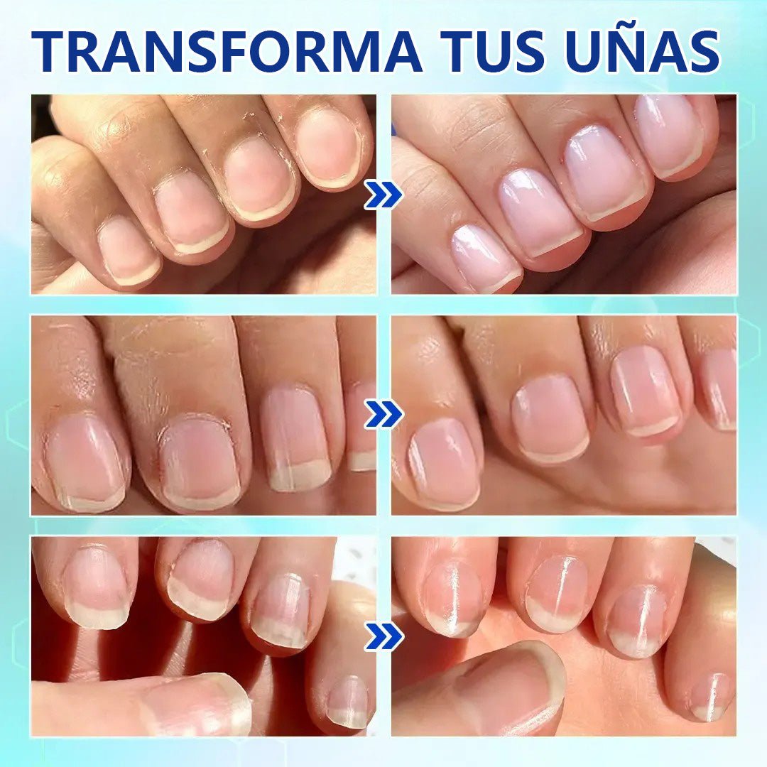 💅✨Cortauñas automático para adultos y niños 👶 - Gimideal💅✨Cortauñas automático para adultos y niños 👶GimidealGimideal💅✨Cortauñas automático para adultos y niños 👶